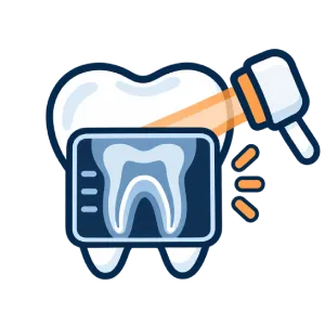 Illustration of a tooth with an X-ray image in front, showing the tooth’s interior, and a scanning device emitting rays toward it.